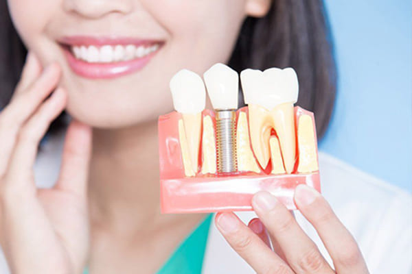Best Dental Implant Treatment in Ahmedabad