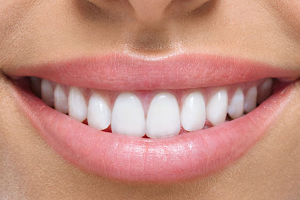 Your Smile is Important for Us, We Provide Complete Dental
                            Care